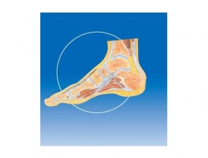 ZM1036-2 踝关节剖面模型