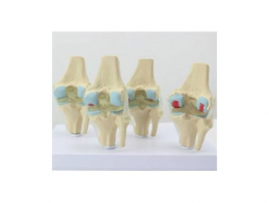 定安县ZMJY/A3007  4个阶段膝关节综合模型