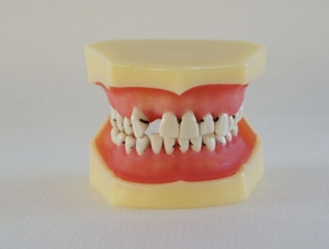 ZM-E2_L4牙周病模型