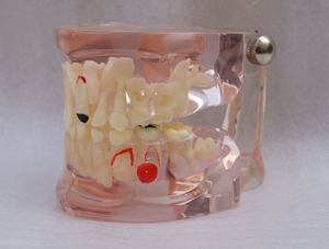 商洛ZM-L13E-01_C7七岁乳恒牙交替模型
