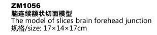 ZM1056脑连续额状切面模型