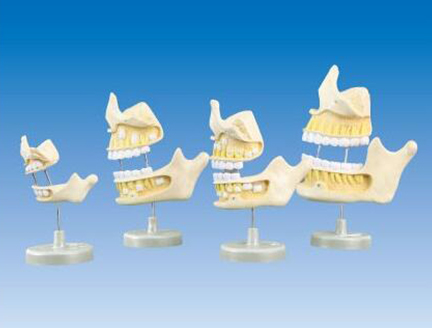 ZM1054牙齿发育模型（新生儿、5岁、9岁、20岁阶段）