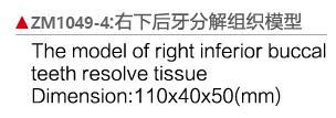 ZM1049-4 右下后牙分解模型