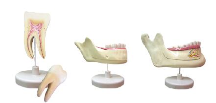 ZM1049 磨牙、乳牙、横牙解剖