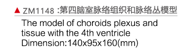 ZM1148 第四脑室脉络组织和脉络丛