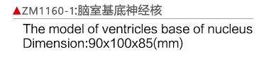 ZM1160-1 脑室基底神经核