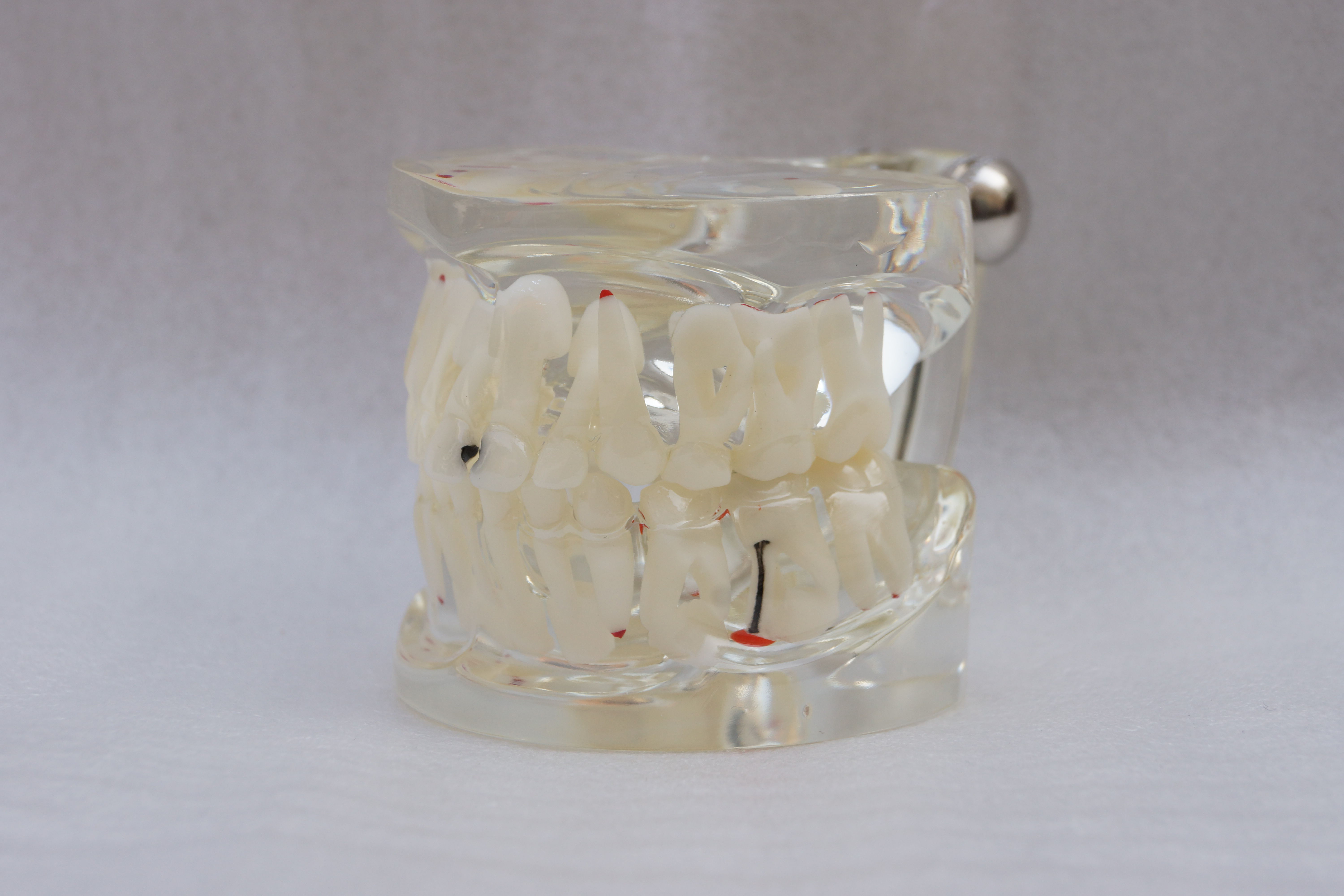 ZM-A12-01_C11乳恒牙交替带龋齿