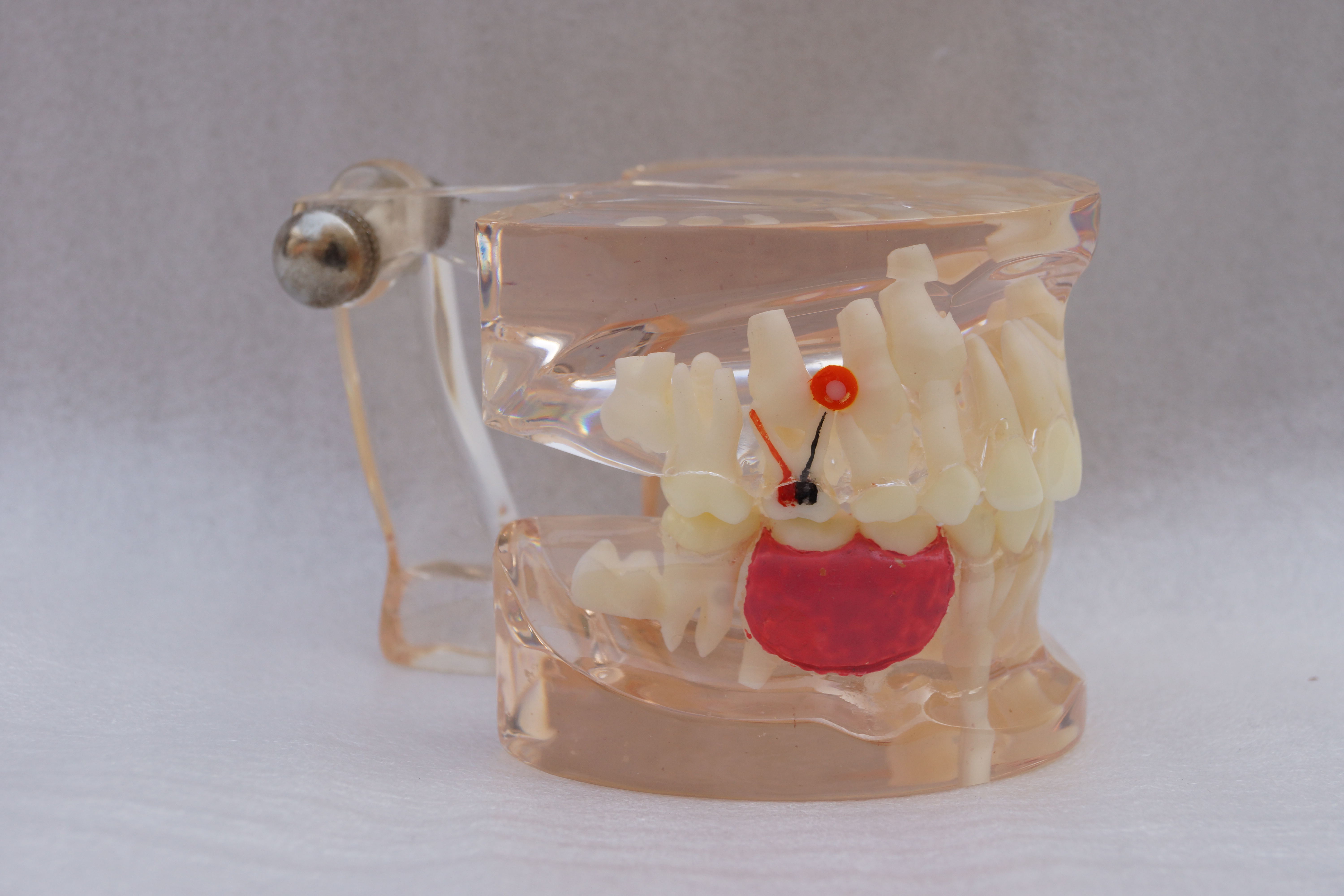 ZM-A16-02_C8乳牙早失病态模型
