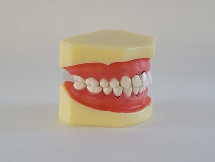 ZM-DSC01956_L3牙周病模型