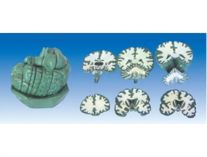 ZM1056 Brain Continuous Frontal Section Model