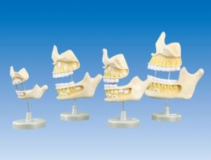 ZM1054 tooth development model (newborn, 5 years old, 9 years old, 20 years old)