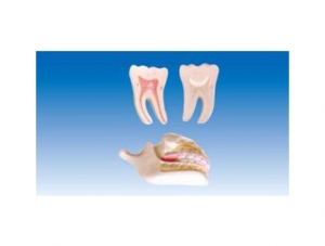ZM1050 dentition and molar model