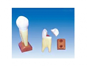 ZM1049-7 maxillary incisor anatomical model