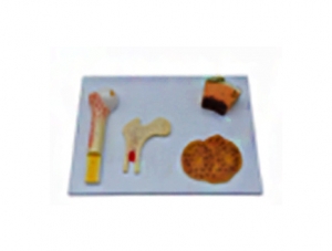ZM1032-1 Bone structure
