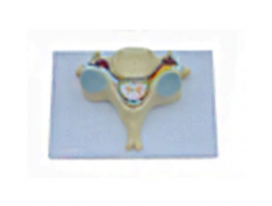 ZM1021-4 Fifth cervical vertebra