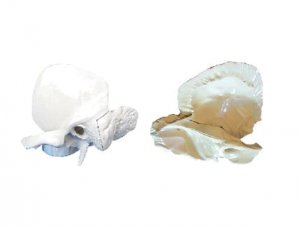 ZM1016-1 Temporal bone enlarged model