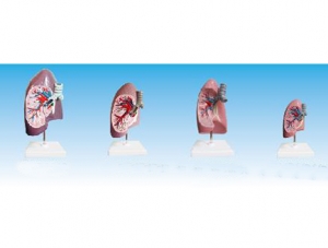 ZM1080-1 Bronchial Right Lung Anatomical Model