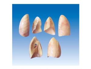 ZM1081 Lung Model