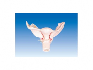 ZM1105 Uterus enlargement