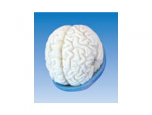 ZM1147-4 Brain and ventricle anatomy