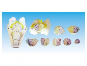 ZM1155 Brain stem cross section