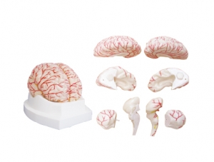 Distribution of ZM1161-1 brain and cerebral arteries