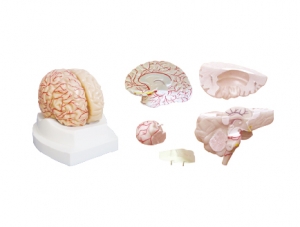 ZM1162 Brain shape and right cerebral blood vessels