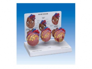 ZM2106 Small Heart Pathology Model