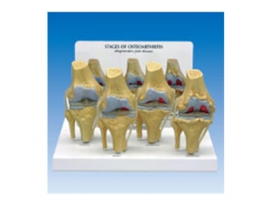 ZM2089 knee joint pathological model