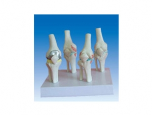 ZM2088 knee joint pathological model