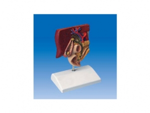 ZM2003 Anatomical Model of Gallbladder Stones
