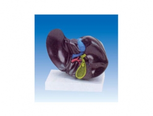 ZM2025 liver and diseased gallbladder model