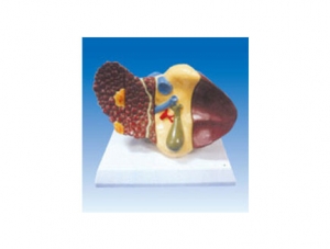 ZM2027 liver cancer model