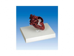 ZM2028 Heartworm Disease Model