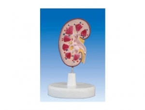 ZM2041 Kidney Stone Anatomical Model