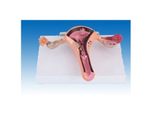 ZM2055 Sick Uterus Model