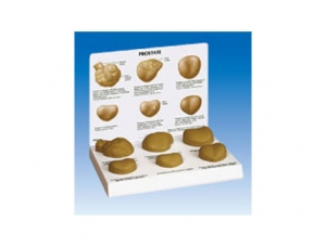 ZM2061 Prostate Pathology Model