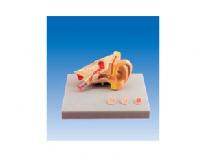 ZM2065 Pathological Ear Model