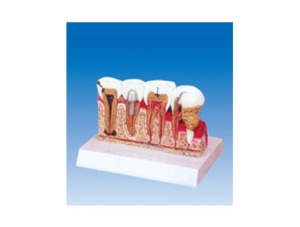 ZM2067 Combination model of common dental diseases