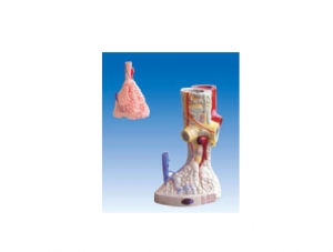 ZM6004 Alveolar enlargement