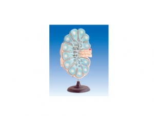 ZM6005 Lymph node enlargement
