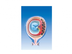 ZM6016 The relationship between fetal membrane and uterus