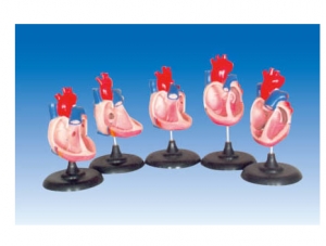 ZM6030 Congenital heart malformation