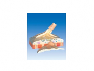 ZM6037 Motion End Plate Model