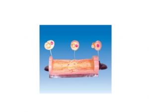 ZM6049 Myelination of peripheral nerve fibers and ultrastructure of myelinated fibers