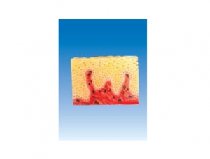ZM6056 Stratified squamous epithelium