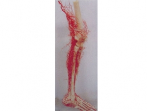 Cast Specimen Series 13
