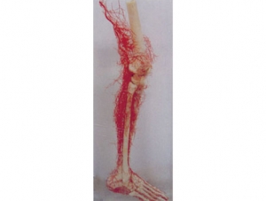 Cast Specimen Series 19