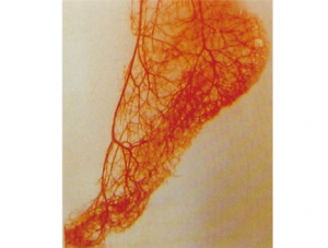 Cast Specimen Series 21