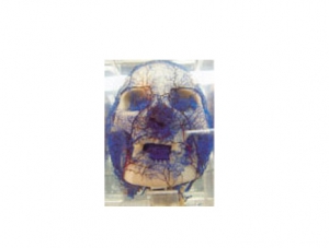 Cast Specimen Series 33